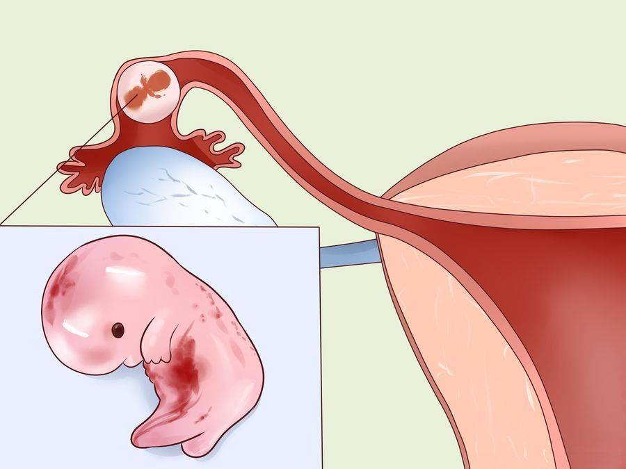 Можно Ли Заниматься Сексом После Имплантации Эмбриона