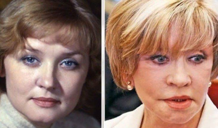 Звезды, которые не делали пластику