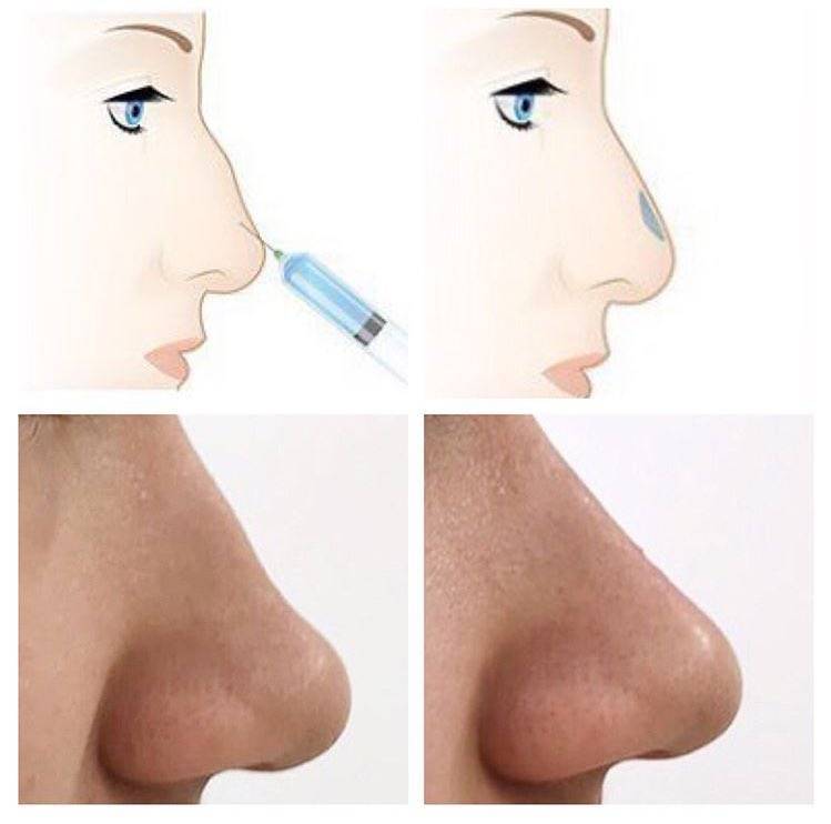 Уменьшить нос с помощью макияжа - советы по визуальной коррекции и нанесению макияжа - твое-личико