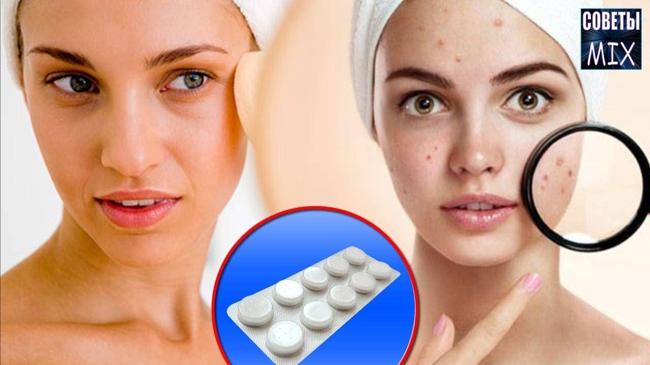 Ацетилсалициловая кислота: 18 масок для лица с аспирином в домашних условиях для кожи