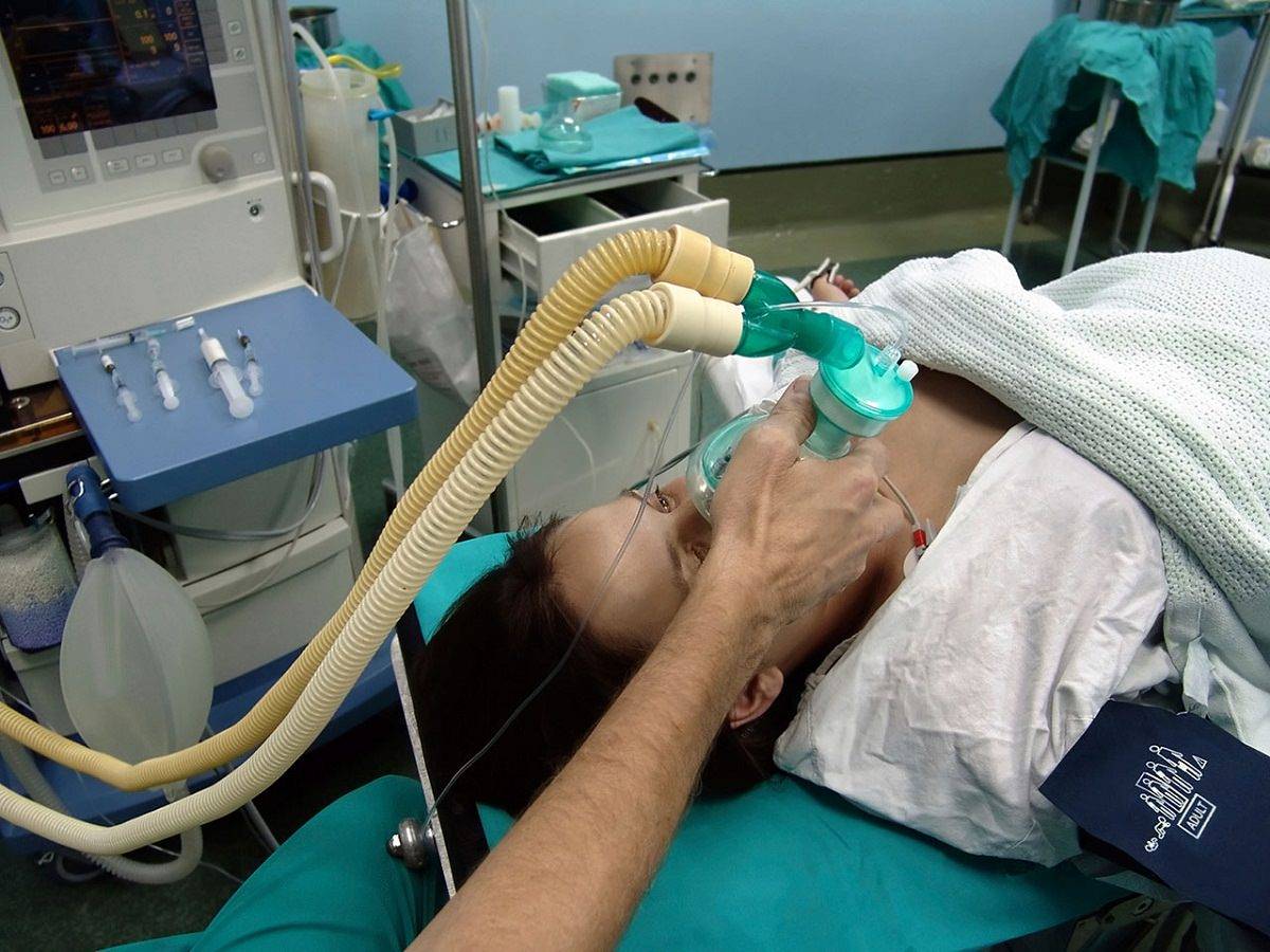 Общий наркоз: показания, проведение, виды и стадии, реабилитация, осложнения