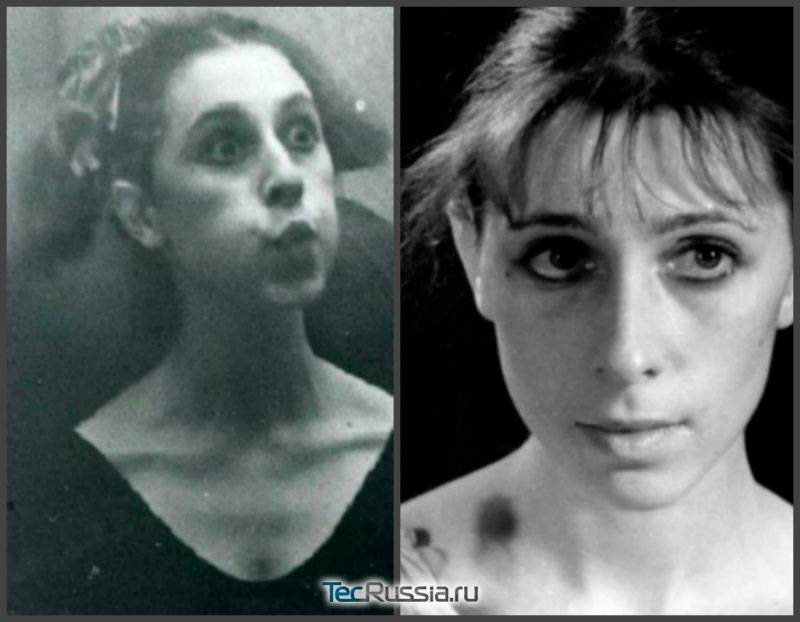 «все натуральное?! ну-ну…» хирурги оценивают российских звезд и определяют, кто из них сделал пластику