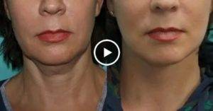 Маски для дряблой кожи – 14 лучших домашних рецептов