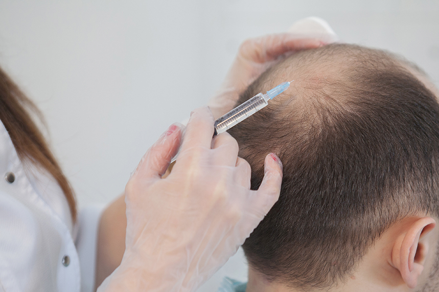 Выпадение волос от хронического простатита