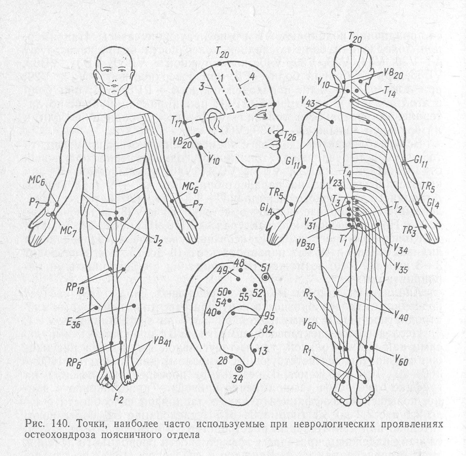 Названия точек человека. Акупунктура тела человека схема болевые точки. Акупрессура точки на теле человека. Иглоукалывание точки на теле схема. Акупунктура при ДЦП точки.