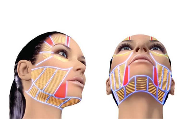 Ультразвуковой лифтинг лица