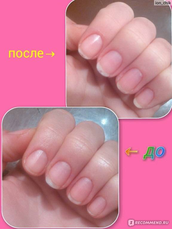10 лучших средств для восстановления ногтей после наращивания в домашних условиях