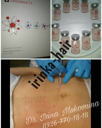 Липолитическая мезотерапия: что это такое, подготовка, как делают, осложнения, за и против