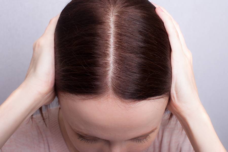Выпадение волос у женщин: причины и методы борьбы