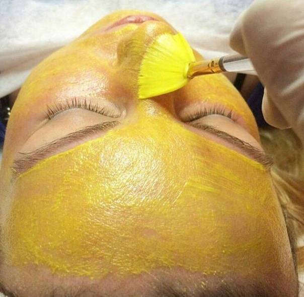 Мартинекс пилинги * желтый, миндальный, ретиноевый, гликолевый