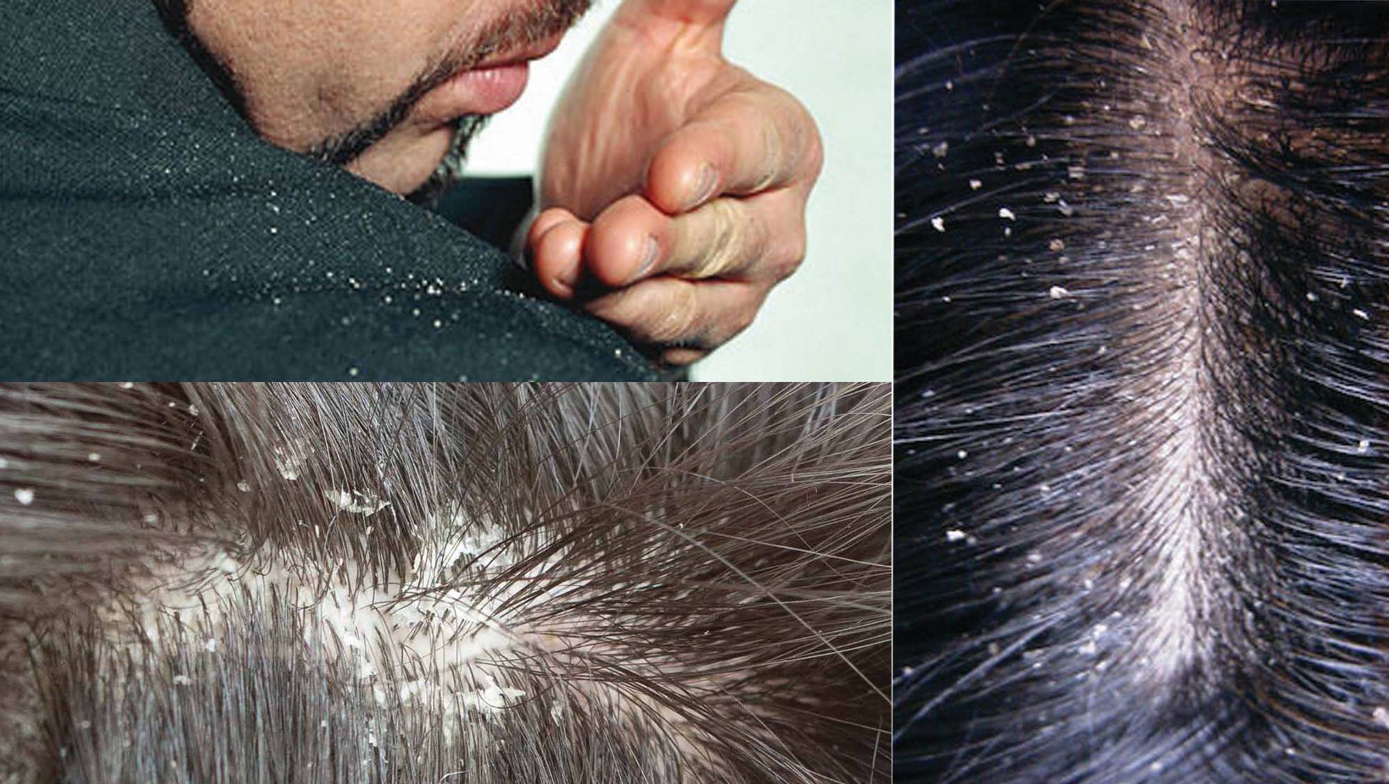 Как исправить генетику волос
