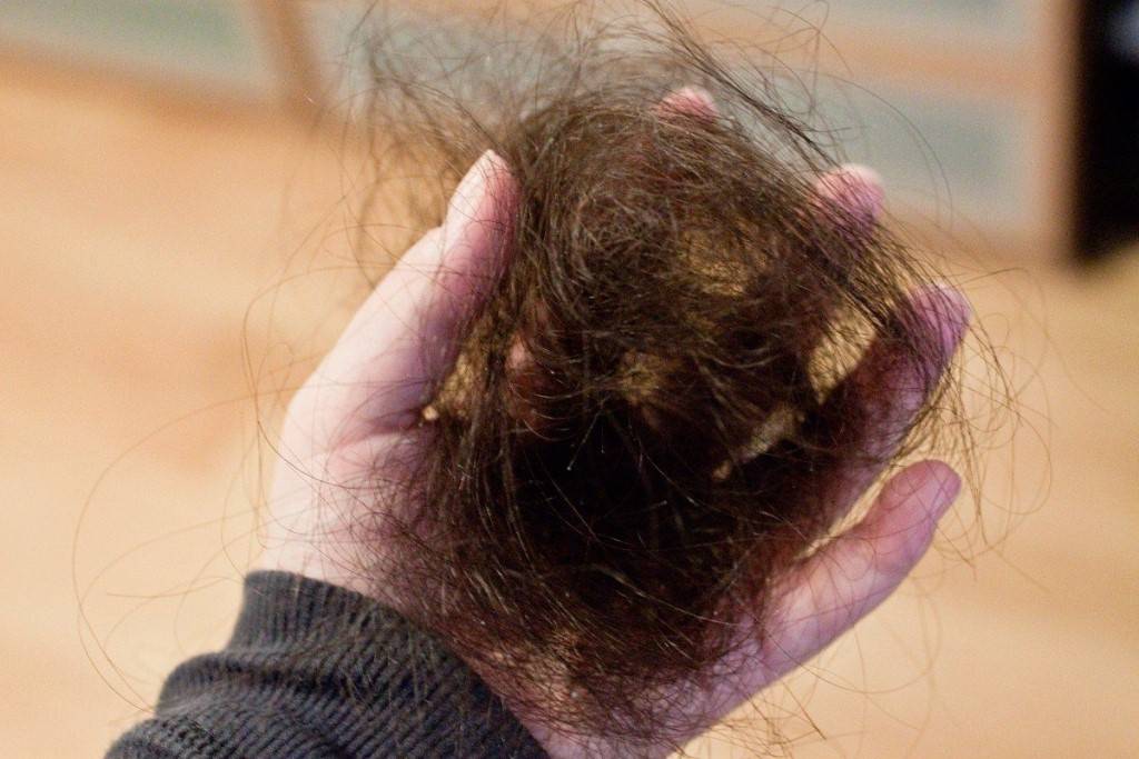 Сезонное выпадение волос у женщин: сколько длится?