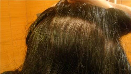 Почему выпадают волосы после мытья