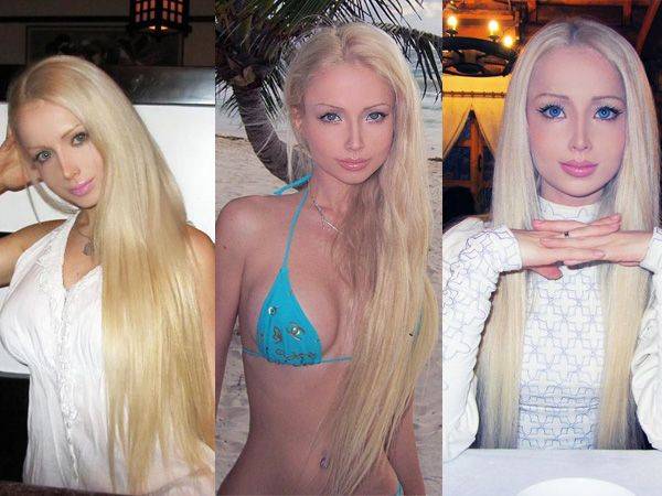 Валерия лукьянова- русская барби до и после пластических операций 