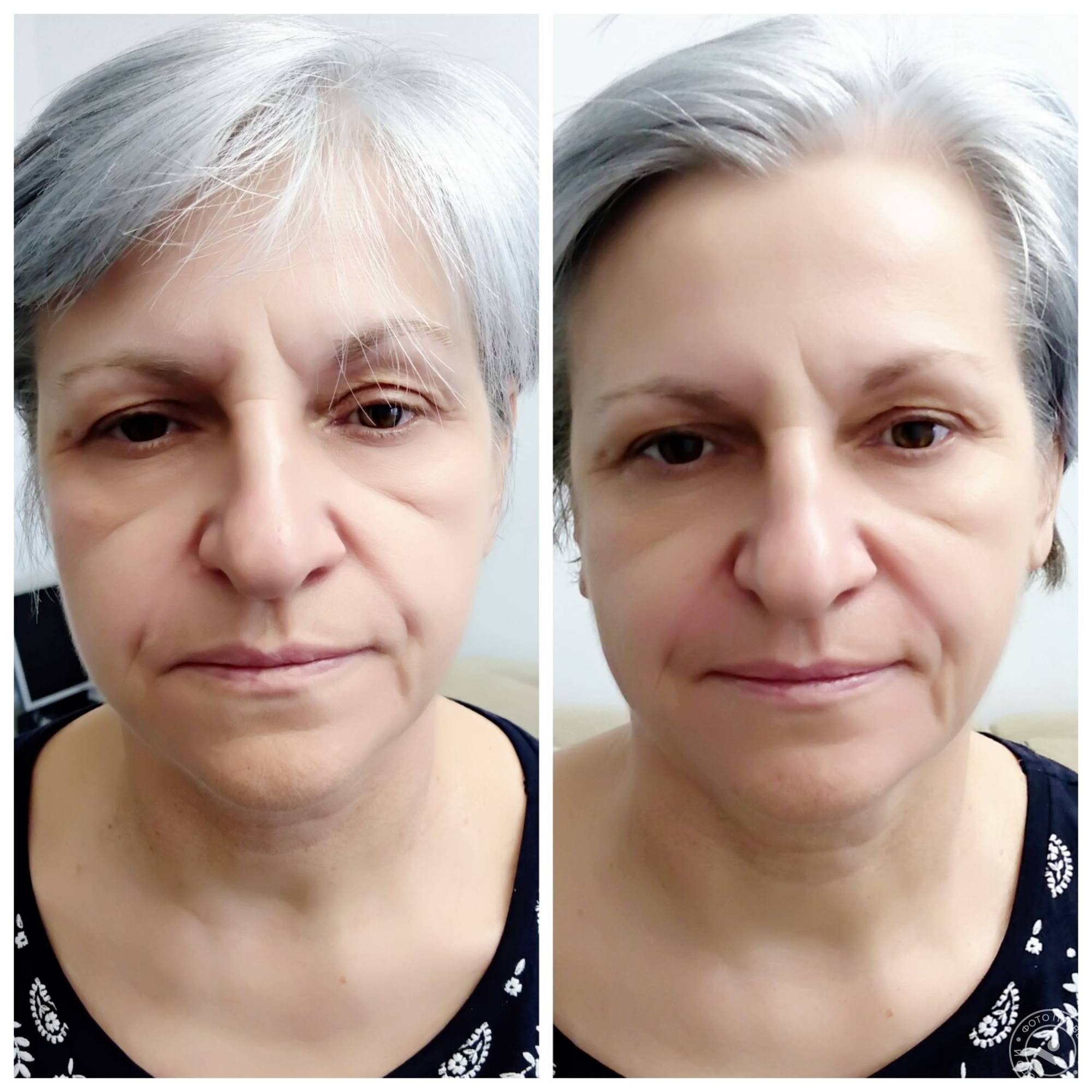 Миофасциальный массаж лица – как сохранить молодость кожи