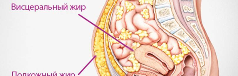 Мицеллярный жир. Подкожный жир и висцеральный жир. Висцеральный жир на животе у мужчин. Висцеральный жир в брюшной полости.