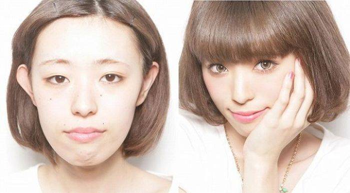 Пластическая хирургия глаз: виды операций, цены, противопоказания, восстановление