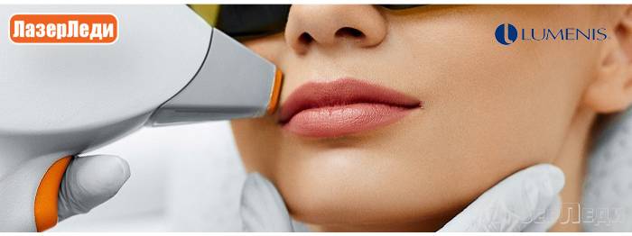 Лазерная эпиляция усиков над верхней губой: противопоказания и последствия