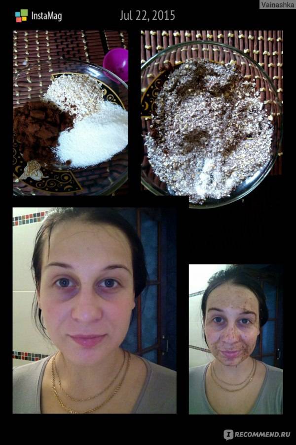 Активированный уголь от прыщей: эффективность, маски