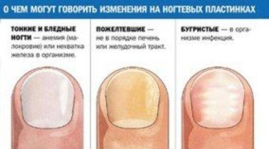 Лунки на ногтях: что это и как диагностировать заболевания по лункам. значение лунок на ногтях