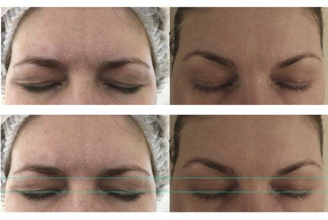 Макияж вместо пластики: делаем «лисий взгляд» за 7 простых шагов