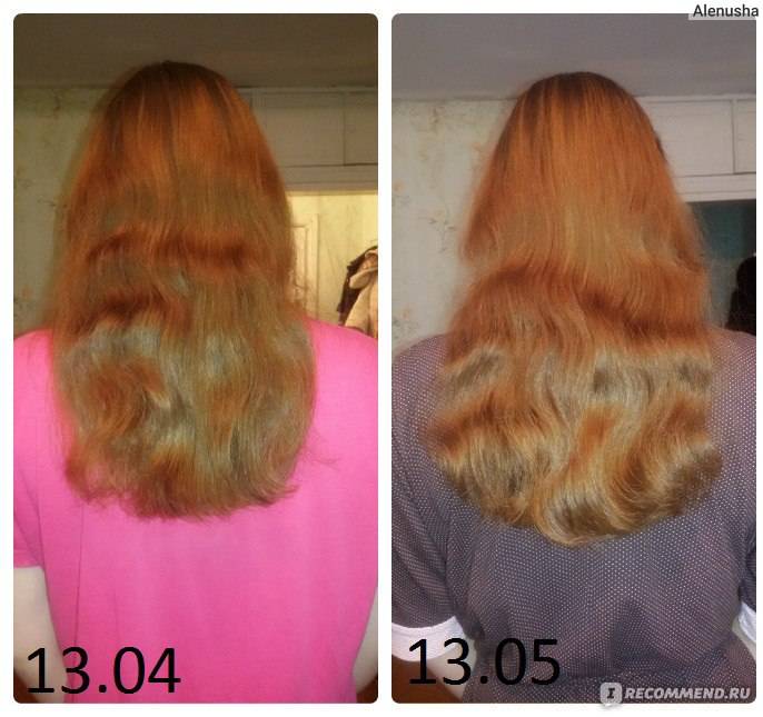 Пентовит (pentovitum) для волос. отзывы, инструкция, фото до и после, цена
