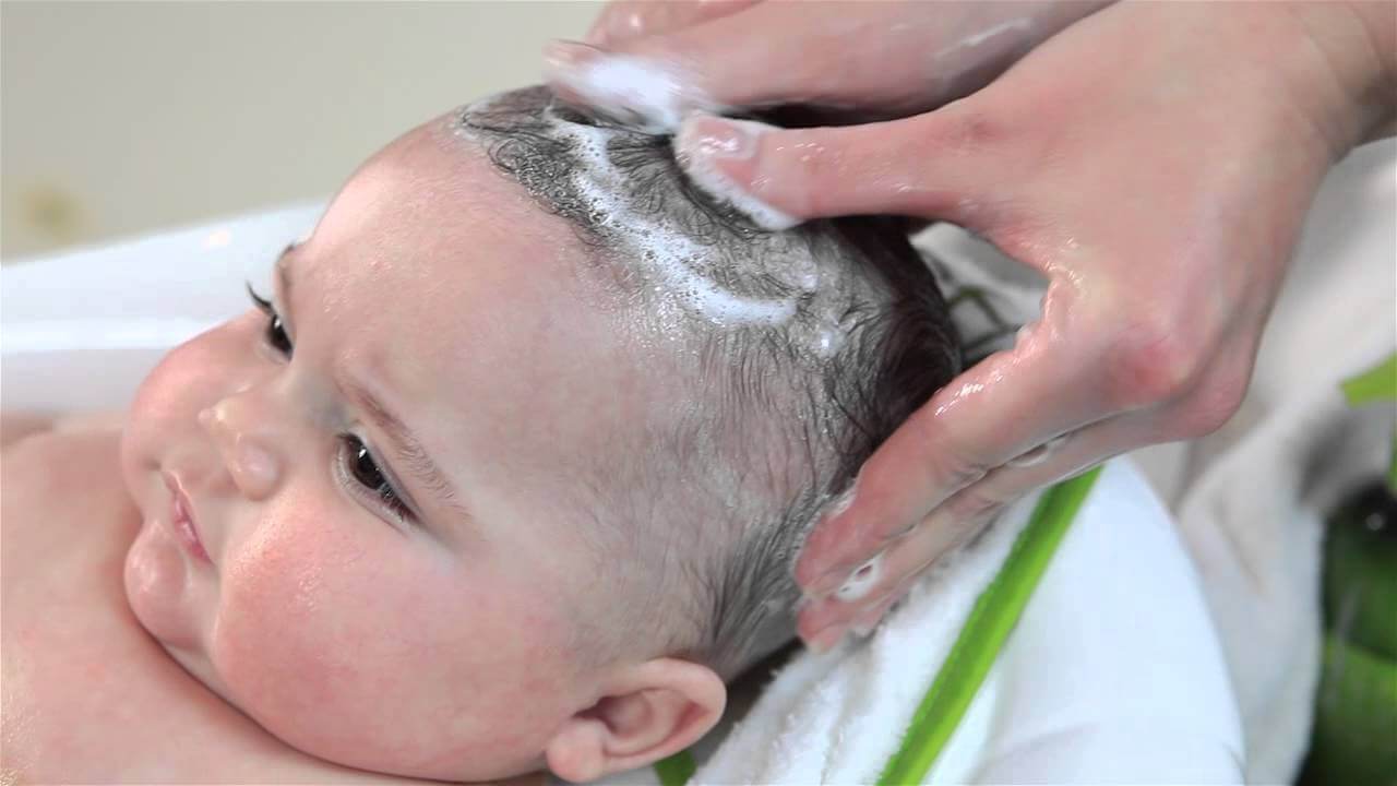 Волосы на лбу ребенка. Гнейс и себорейный дерматит. Гнейс на волосистой части головы.
