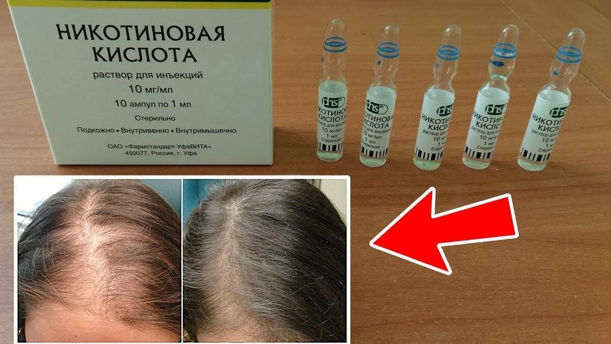 Никотиновая кислота в ампулах для волос: ее применение точно поможет!