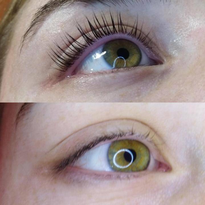 Botox ресниц: фото, что это такое и зачем нужно, каковы плюсы и минусы процедуры, лучше ли она наращивания и других аналогов, а также часто ли можно делать ботокс?