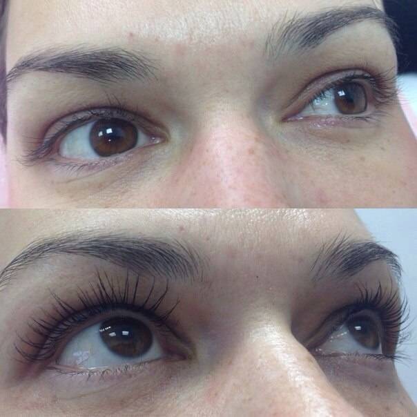 Кератиновый лифтинг: описание процедуры