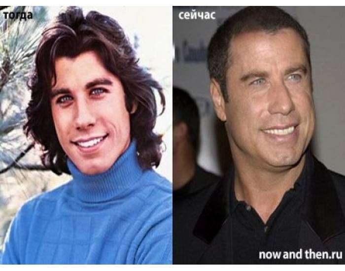 7 звезд, которые никогда не делали пластику