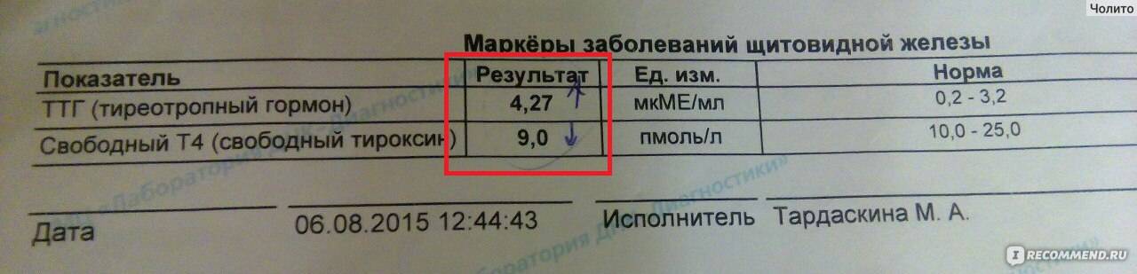 Анализ т4 свободный. Гормоны щитовидной железы ТТГ И т4. Нормы анализов щитовидной железы ТТГ т3 т4. Гормон ТТГ св т4. Т4 гормон щитовидной железы норма.