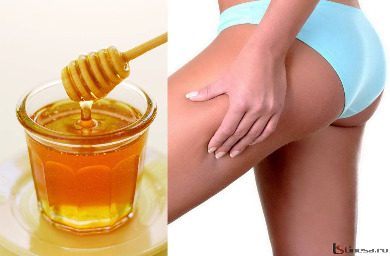 Обертывание медом для похудения рецепт в домашних условиях