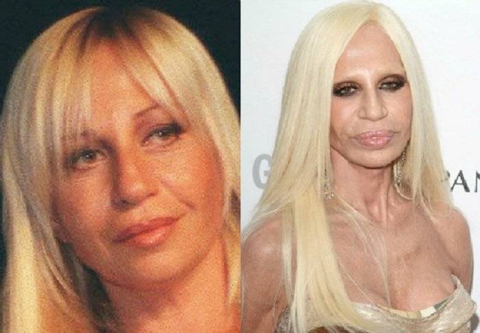 «все натуральное?! ну-ну…» хирурги оценивают российских звезд и определяют, кто из них сделал пластику