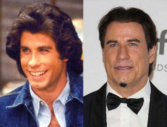 Звезды, прославившиеся после пластики: российские, голливудские, 2019 - 24сми