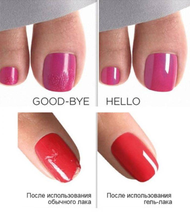 Чем отличается гель-лак от обычного лака