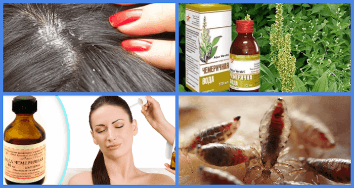Как избавиться от перхоти волос народными средствами
