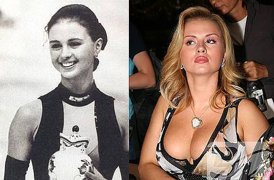 Звезды, которые не делали пластику