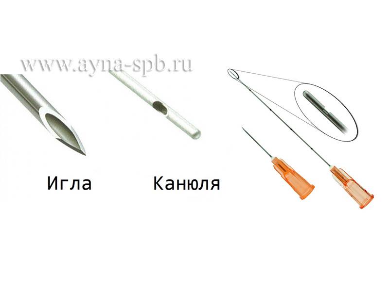 Канюля. что это такое, применение в косметологии, контурной пластике. внутривенная, инфузионная мини канюля. фото