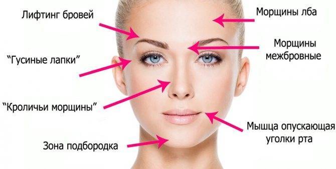 Ботокс и аллергия на него: неприятные последствия «волшебных» уколов