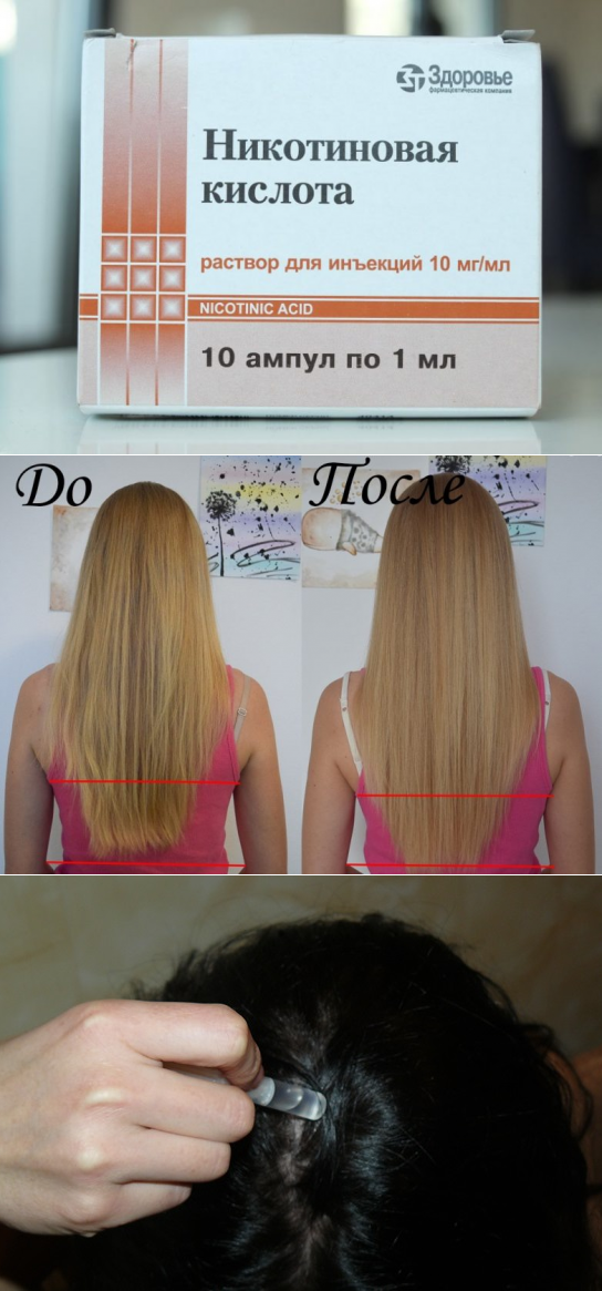 Пентовит для роста волос: курс лечения