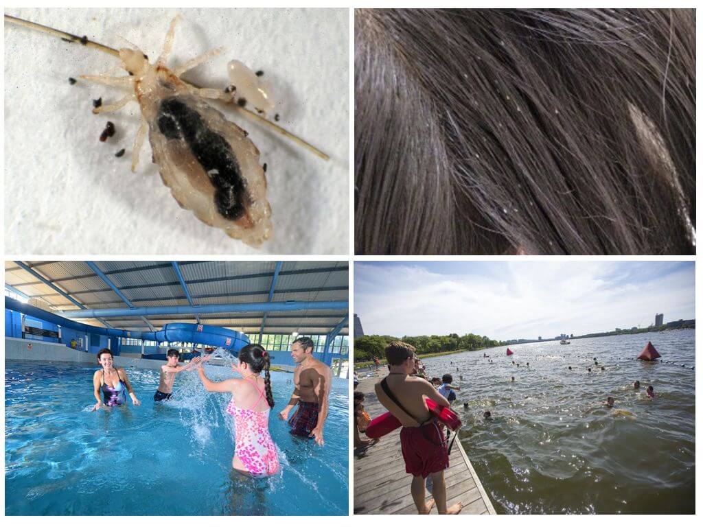 ❶ как передаются вши от человека к человеку