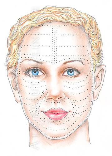 Дмае мезотерапия: состав препарата для лица, схема введения
