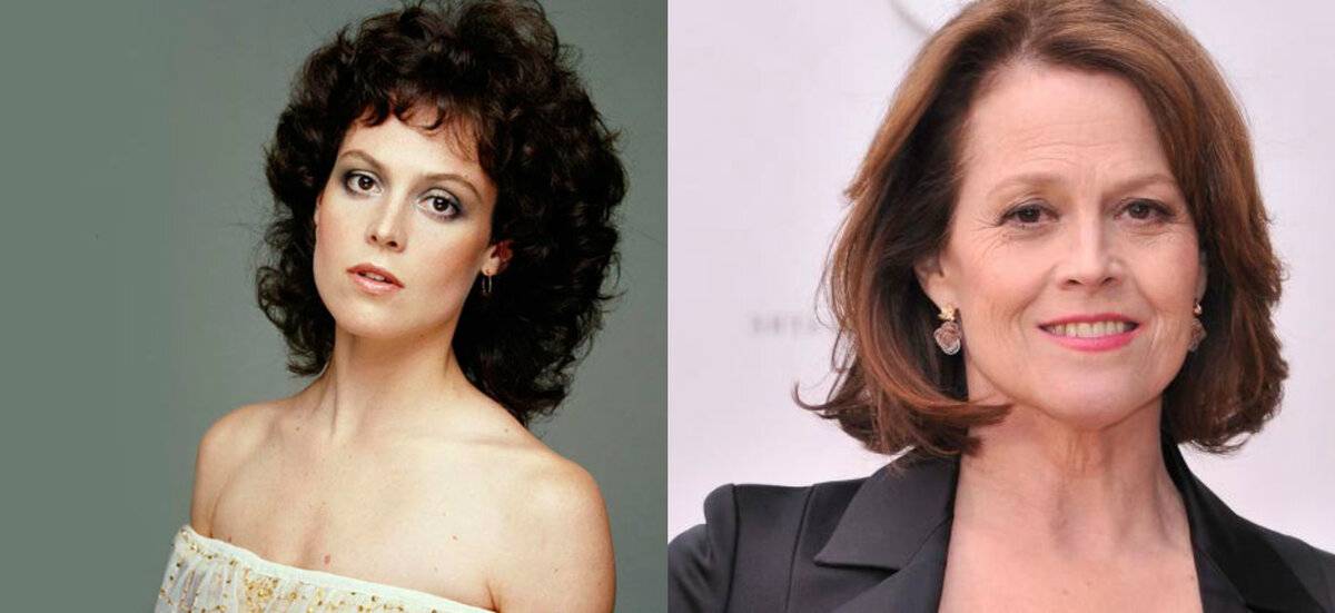 Звезды делавшие пластические операции: фото до и после