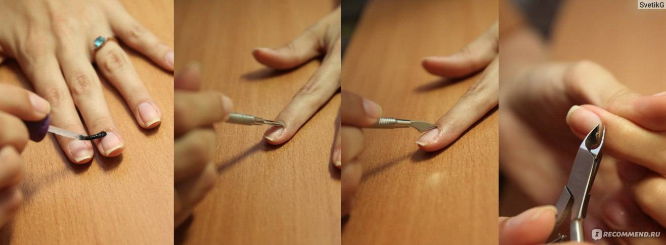 Как навсегда избавиться от кутикулы в домашних условиях