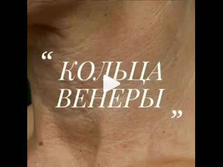 Как убрать кольца венеры на шее: 8 способов