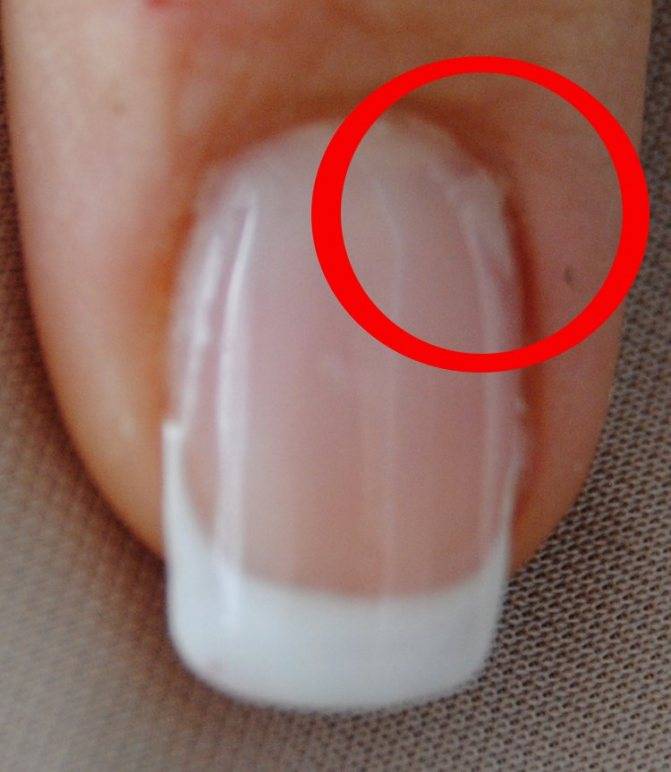 Почему отваливаются ногти гель