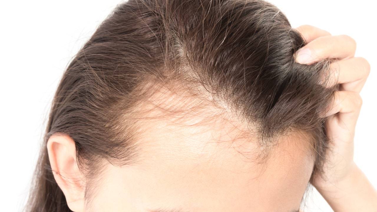 Пять причин, почему выпадают волосы, и как остановить их потерю | новости