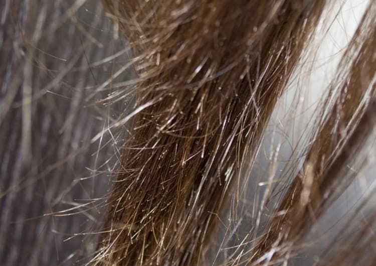 Волосы секутся по всей длине: почему и что делать?