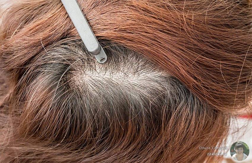 Какая скорость роста волос на голове, и от чего она зависит?